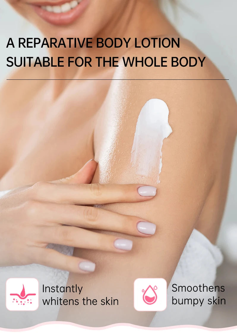 JoyPretty Chicken Remover Skin Care Body Cream Keratosis Pilaris Treatment Skin Repair Body Lotion Moisturizing Whiten Body Care