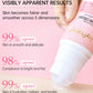 JoyPretty Chicken Remover Skin Care Body Cream Keratosis Pilaris Treatment Skin Repair Body Lotion Moisturizing Whiten Body Care